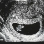 seis semanas de gravidez